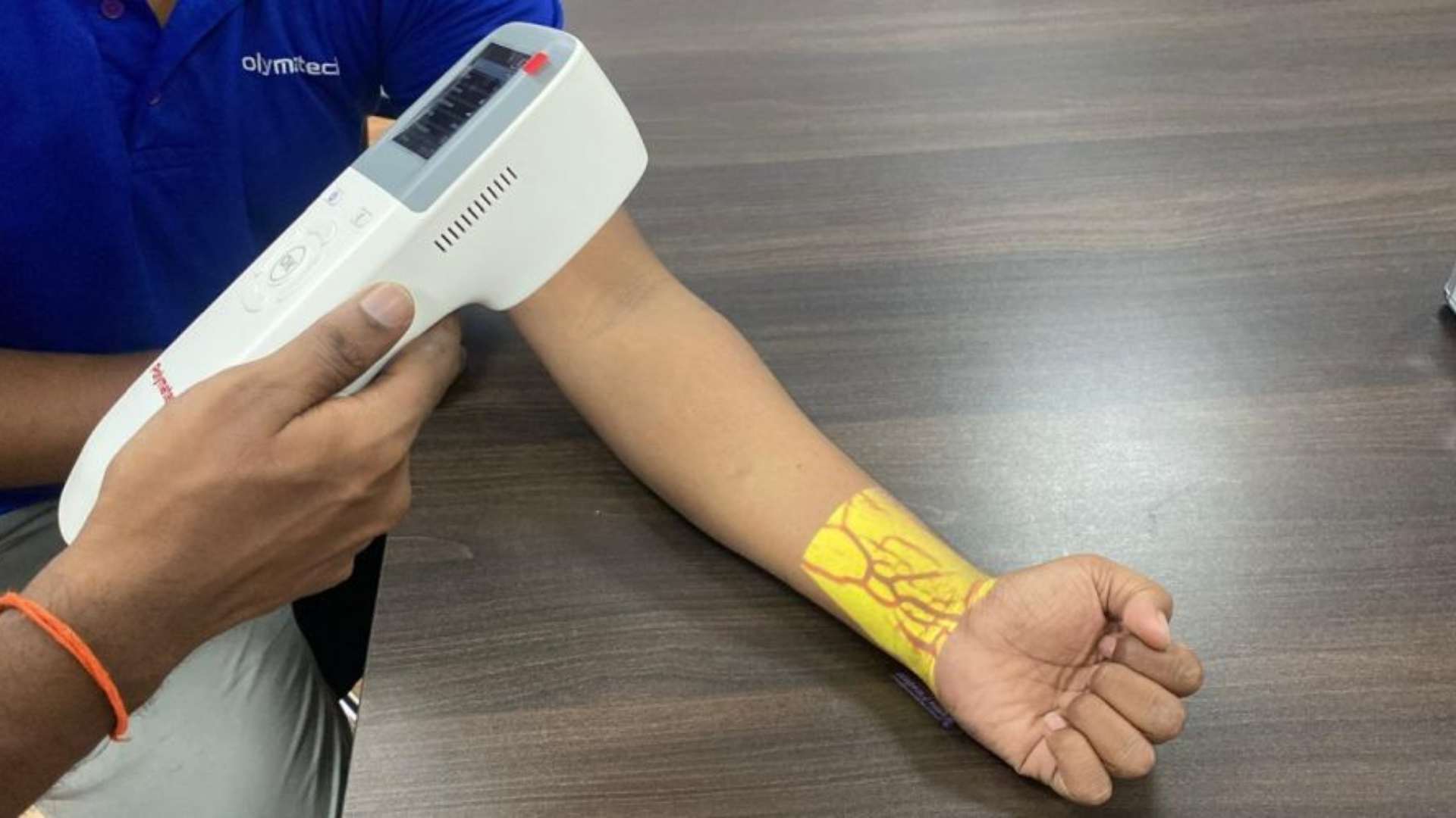 Polymatech Makes History with India's First CDSCO-Approved Indigenous Vein Fi...